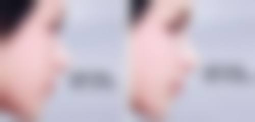 三、孩子缝针疤痕去除之需要警惕的特殊情况