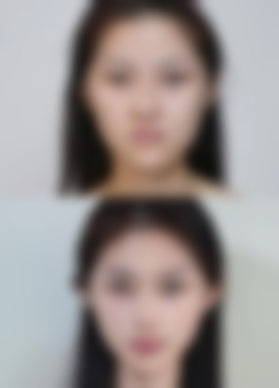 四、孩子缝针疤痕去除之生活习惯与饮食调整