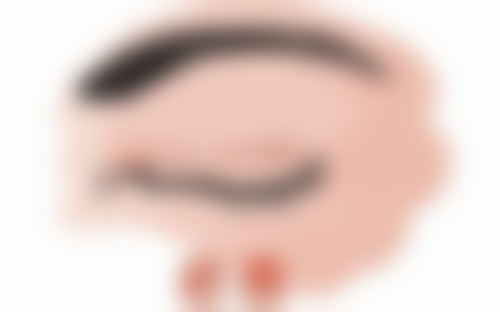 二、无痕去眼袋的成效怎么样