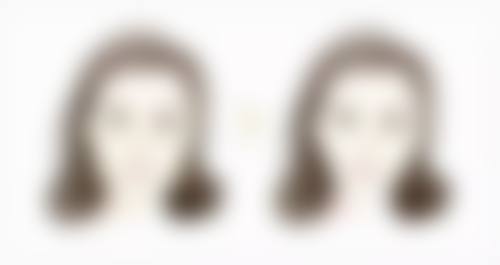 五、无痕去眼袋的注意事项