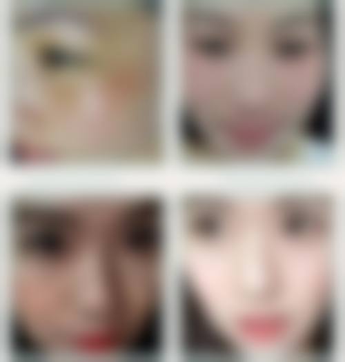 三、石家庄怡美整形诊疗项目有哪些？