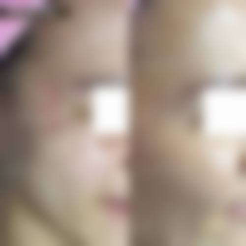 五、盘锦王尧整形医院价格表