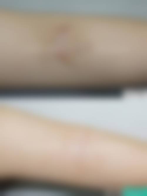 八、解放军一八一医院医学整形美容科真实的患者评价