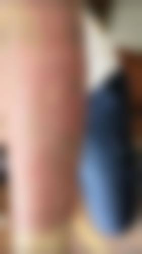 八、成都武侯春语医疗美容预约方式