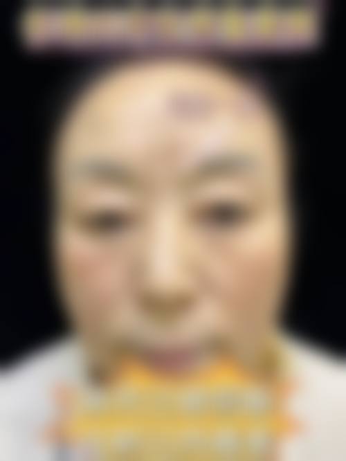 三、韩国江南延世整形外科诊疗项目有哪些？