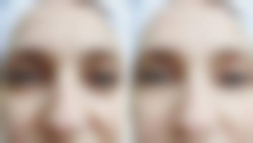 三、盘锦王尧整形医院诊疗项目有哪些？