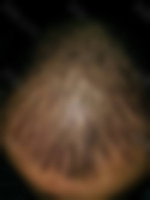 八、宁波美生源医疗美容医院真实的患者评价