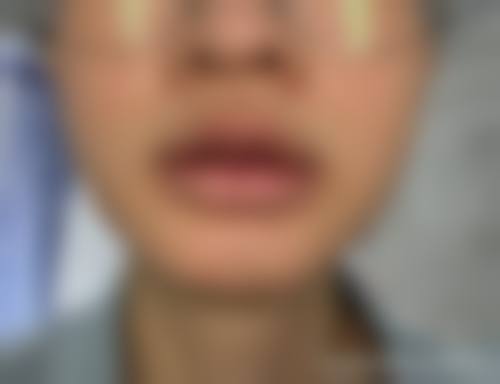 二、解放军一八一医院医学整形美容科怎么样？