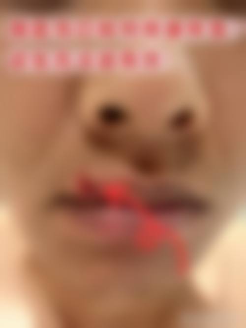 六、成都武侯春语医疗美容价格表