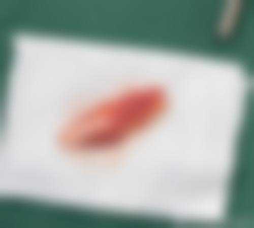 二、韩国江南延世整形外科怎么样？