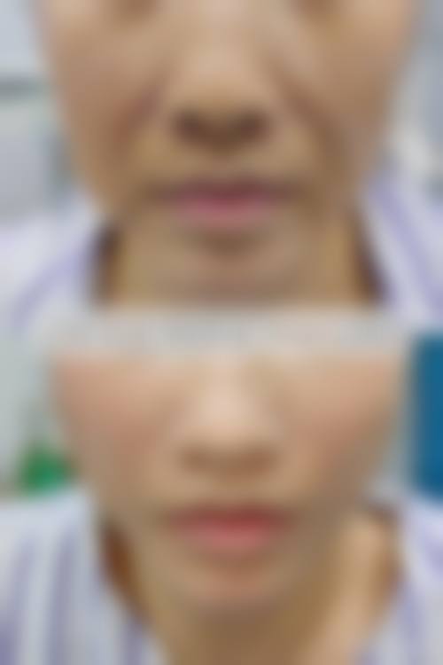 四、成都武侯春语医疗美容特色项目