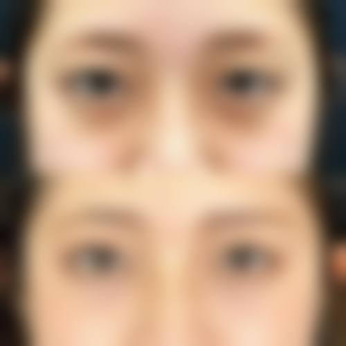 四、解放军一八一医院医学整形美容科特色项目