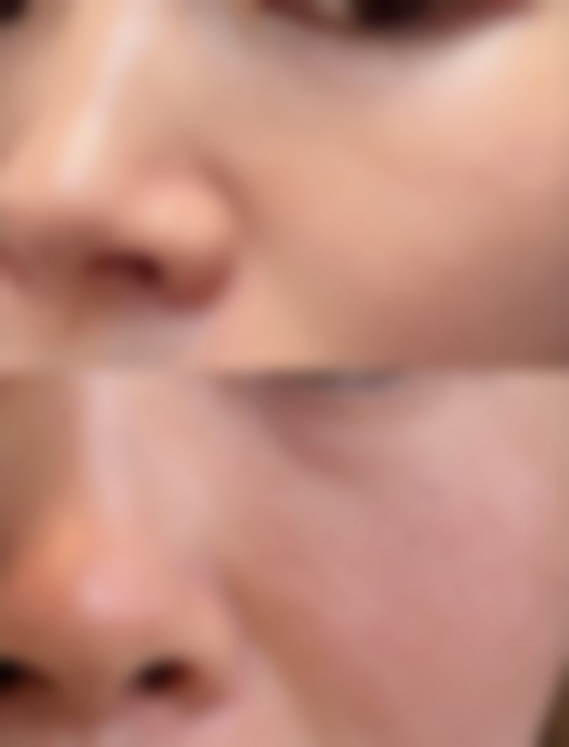 四、宁波美生源医疗美容医院特色项目