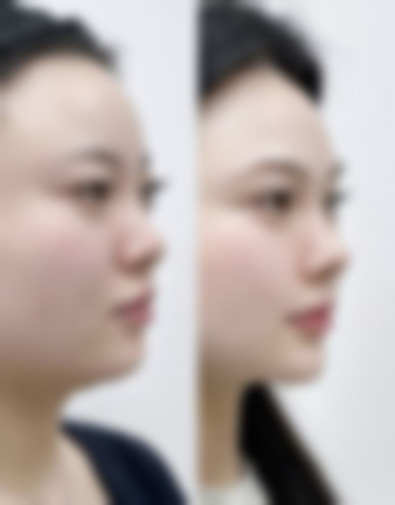 五、乌鲁木齐梁青松医疗美容价格表