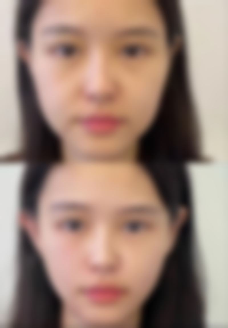 八、扬州美康医疗美容门诊部真实的患者评价