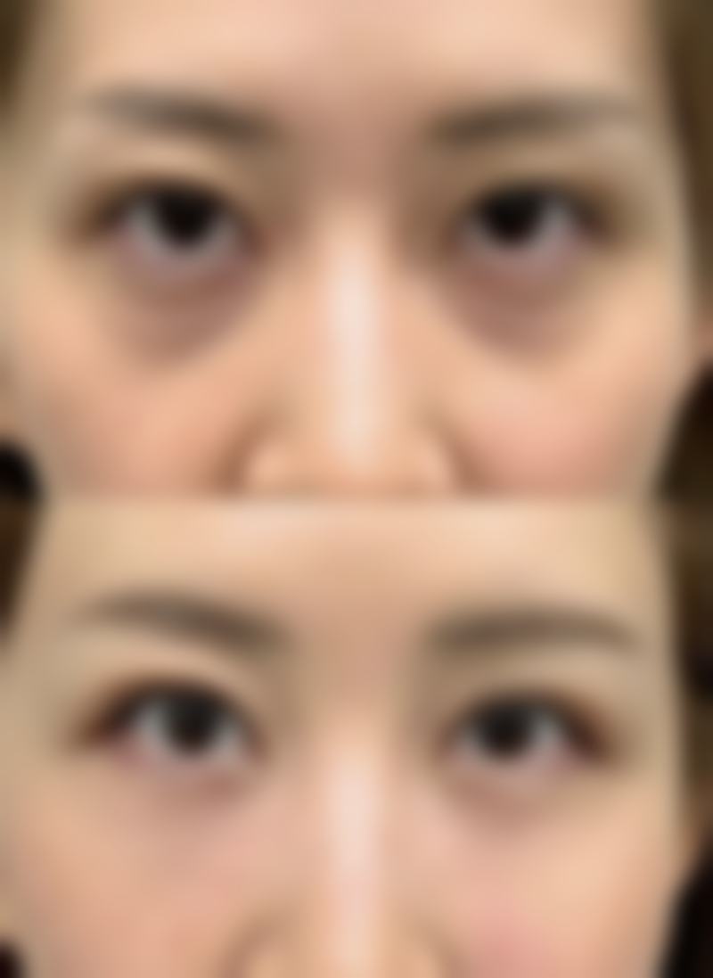 四、轻医美干预手段