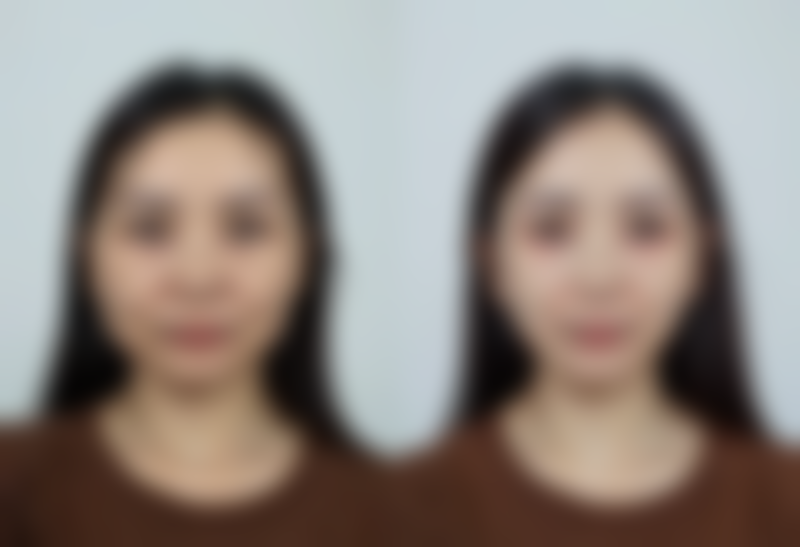 六、修复异常情况处理