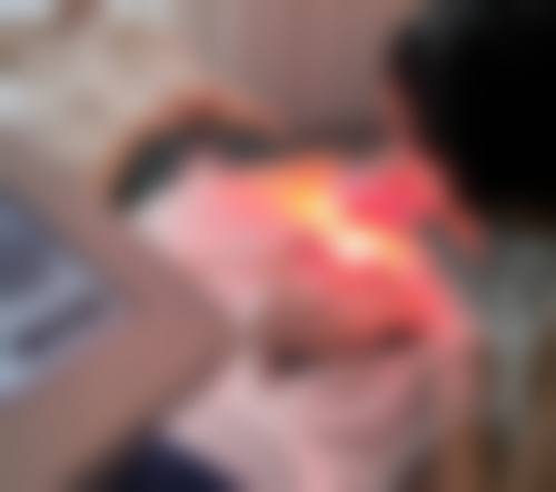 八、郑州洪波整形美容医院真实的患者评价