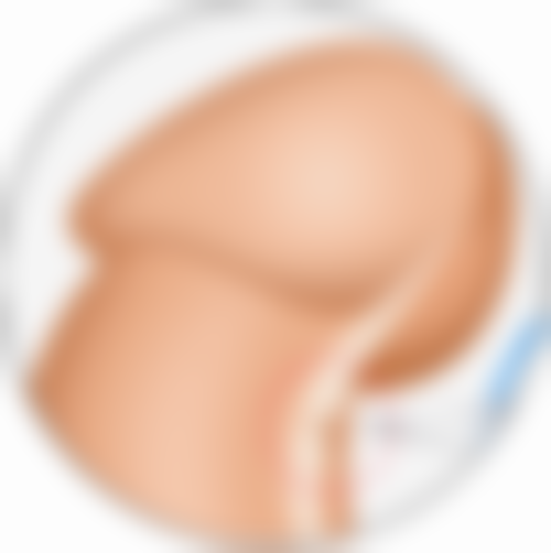 二、全切双眼皮修复期的用药与禁忌