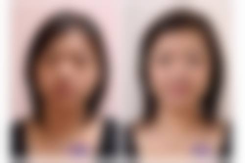 二、蒸汽眼罩能去眼袋吗？不同类型眼袋的答案不同