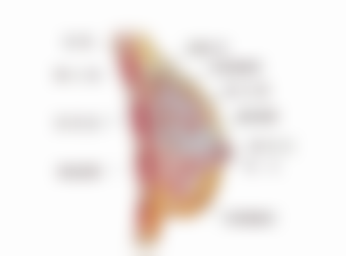 gabry假体隆胸是是什么牌子？盘点热门假体隆胸牌子为你解惑 