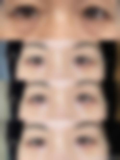 三、韩国Brandnew整形医院诊疗项目有哪些？