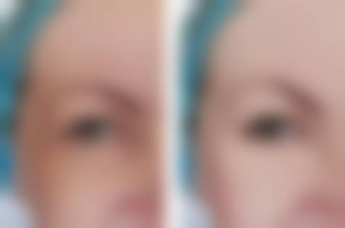 九、韩国Brandnew整形医院真实的患者评价