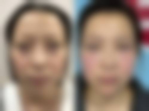 二、郑州洪波整形美容医院怎么样?