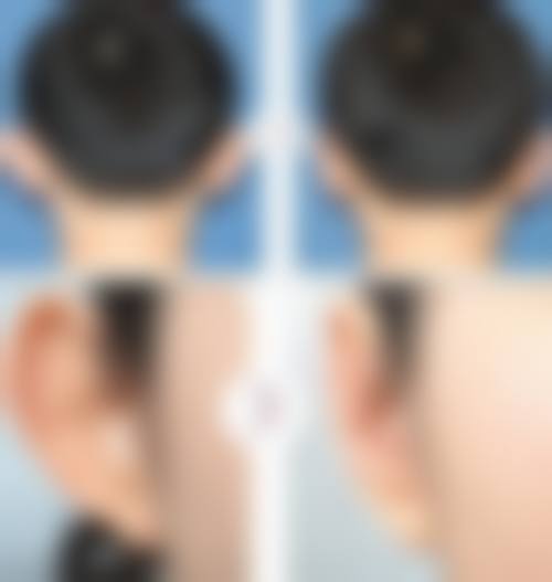 四、Garden Clinic大阪特色项目