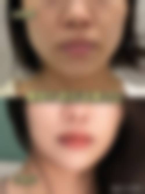 四、广州缔妍医疗美容医院特色项目