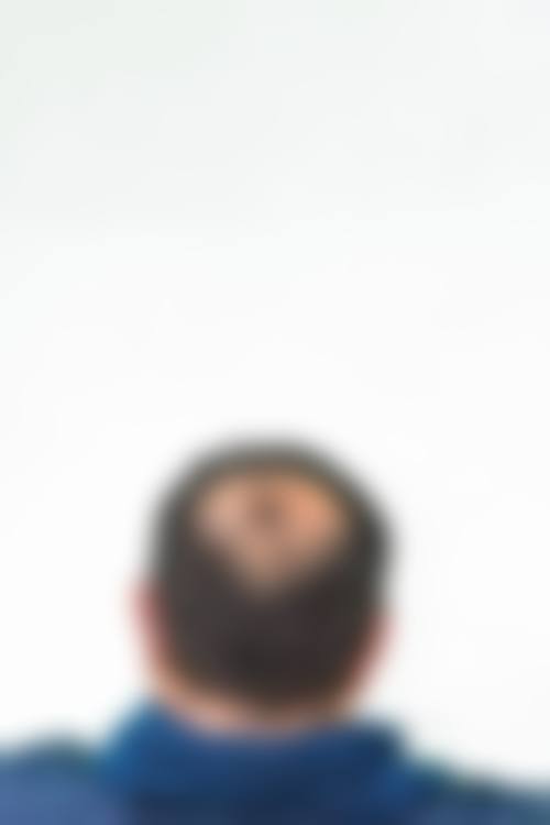 六、苏州新生植发医院价格表