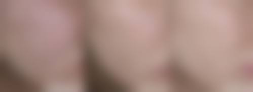 五、广州缔妍医疗美容医院价格表