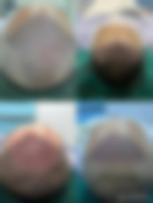 四、苏州新生植发医院特色项目