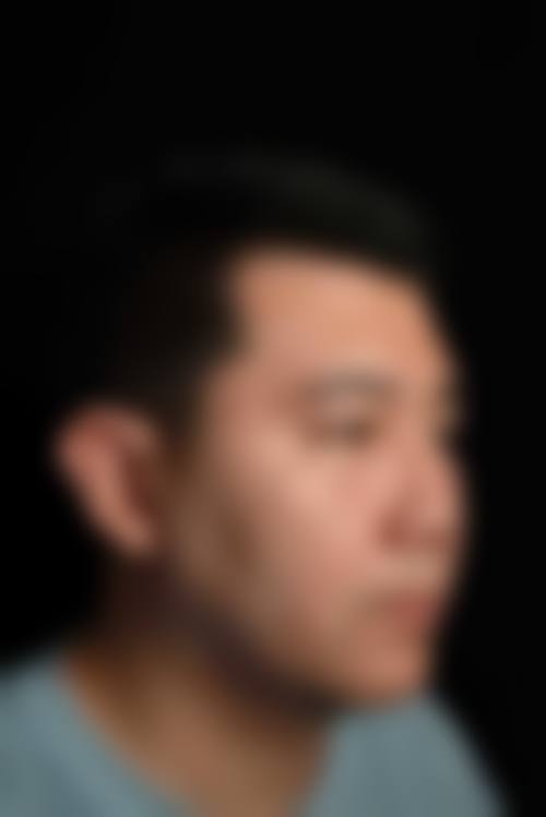 四、长沙丽臻医疗美容门诊部特色项目