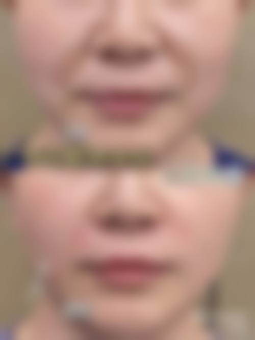 七、合肥瑞亚整形医院地址及交通