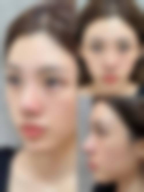 六、深圳皇佳亿美医疗美容价格表