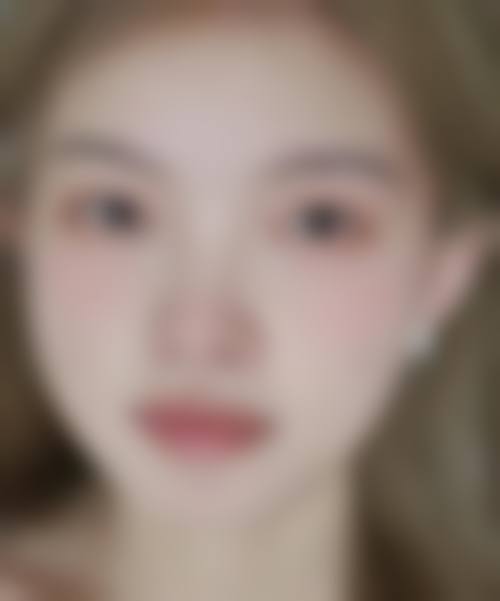 九、成都鹏爱悦己医疗美容医院真实的患者评价