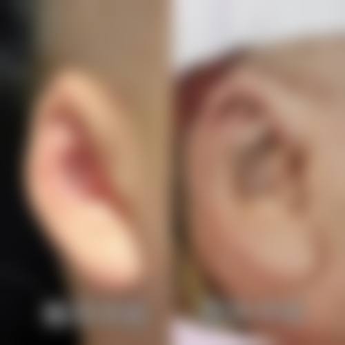 四、武汉铂恩(肽慕)医疗美容门诊部特色项目