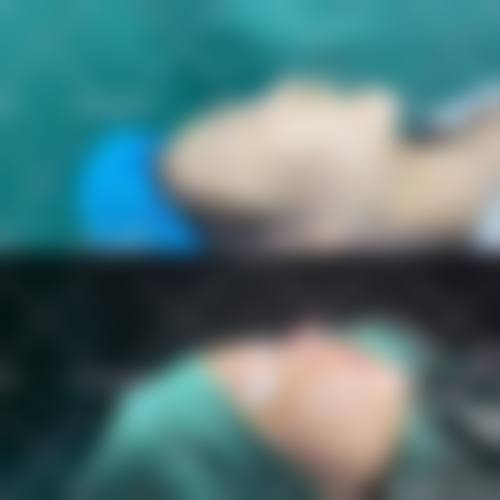 八、韩国Brandnew整形医院预约方式