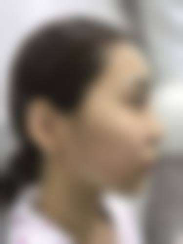 四、郴州臻颜美医疗美容诊所特色项目