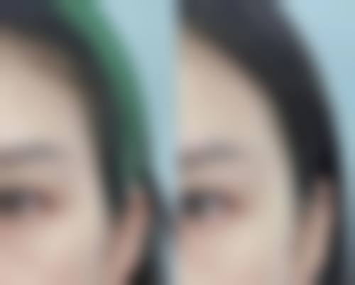 八、解放军第990医院整形美容外科(原159医院)预约方式