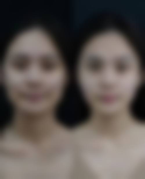 四、成都鹏爱悦己医疗美容医院特色项目