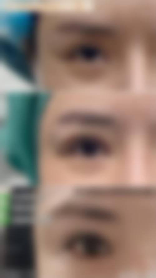 四、佛山中医和西医结合医院门诊部 - 美容皮肤科门诊特色项目