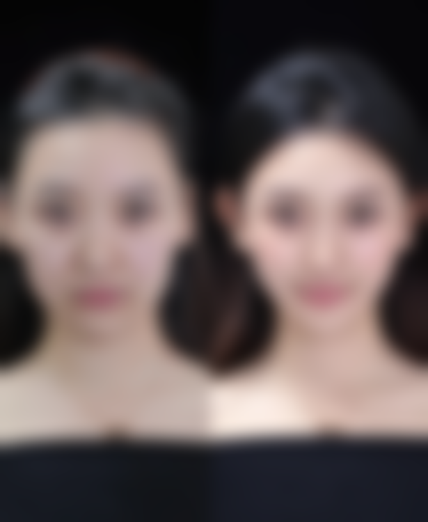 二、其他可能出现的后遗症