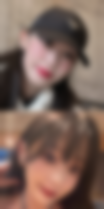 四、河南商丘昕瑶整形医院特色项目