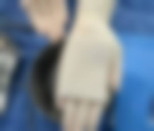 二、叶锋医生:眼部综合的专精大师