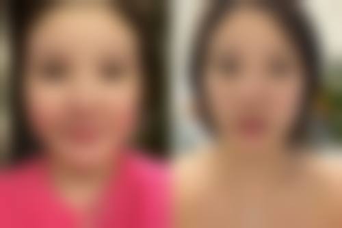 四、美学改善及注意事项