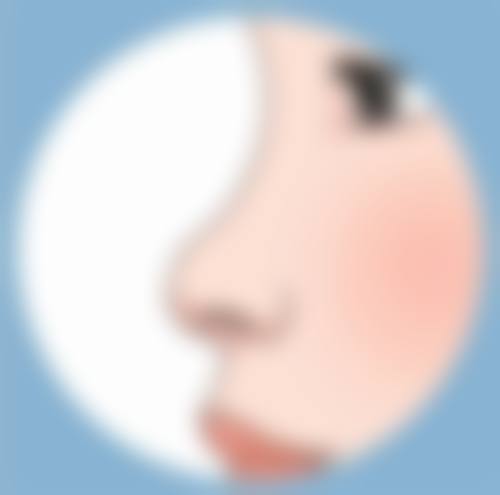 一、认识疤痕疙瘩和疤痕增生