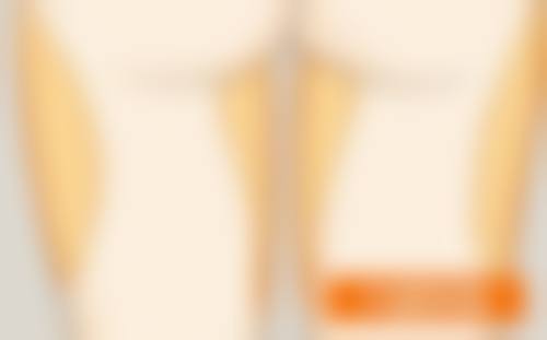 二、三点双眼皮到底是不是恒久的