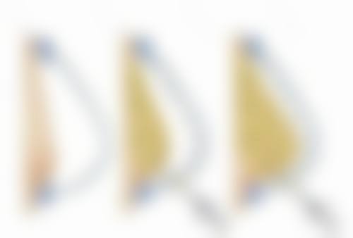 五、疤痕疙瘩和疤痕增生的日常护理